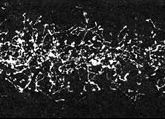 Photograph of an X-ray cloud in a Wilson Cloud Chamber